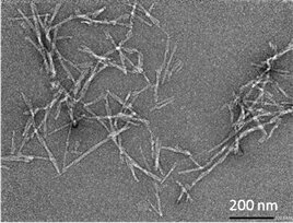 Understanding the growth of disease-causing protein fibres