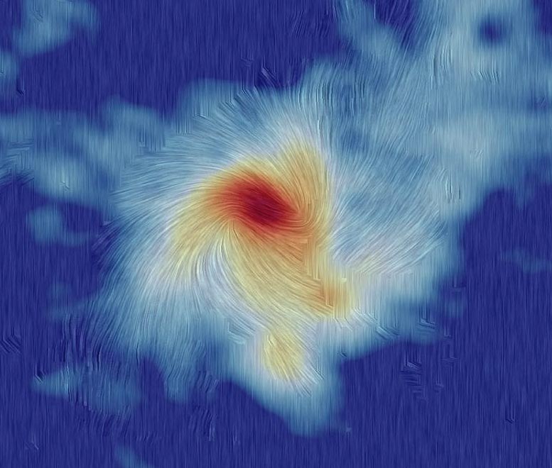 Interplay Between Magnetic Force and Gravity in Massive Star Formation