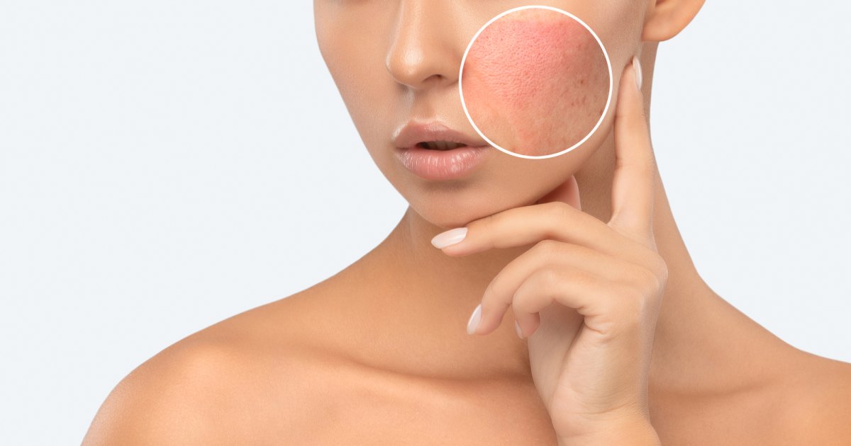 Skin Freaking Out? These 7 pH-Balancing Products Could Help